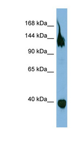 SEMA6A / Semaphorin 6A Antibody - SEMA6A antibody Western blot of OVCAR-3 cell lysate. This image was taken for the unconjugated form of this product. Other forms have not been tested.