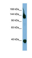 SEMA6A / Semaphorin 6A Antibody - SEMA6A antibody Western blot of OVCAR-3 cell lysate. This image was taken for the unconjugated form of this product. Other forms have not been tested.