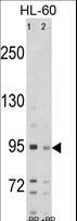 SEMA6A / Semaphorin 6A Antibody - Western blot of SEMA6A Antibody antibody pre-incubated without(lane 1) and with(lane 2) blocking peptide in HL-60 cell line lysate. SEMA6A (arrow) was detected using the purified antibody.
