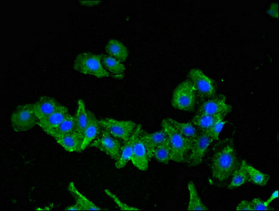 SEMA6A / Semaphorin 6A Antibody - Immunofluorescent analysis of HepG2 cells using SEMA6A Antibody at dilution of 1:100 and Alexa Fluor 488-congugated AffiniPure Goat Anti-Rabbit IgG(H+L)