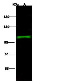 SEMA6A / Semaphorin 6A Antibody - Anti-SEMA6A rabbit polyclonal antibody at 1:500 dilution. Lane A: Raji Whole Cell Lysate. Lysates/proteins at 30 ug per lane. Secondary: Goat Anti-Rabbit IgG H&L (Dylight 800) at 1/10000 dilution. Developed using the Odyssey technique. Performed under reducing conditions. Predicted band size: 114 kDa. Observed band size: 107 kDa.