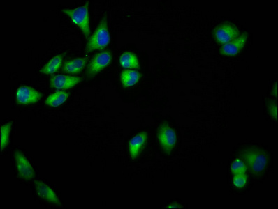SEMA6B / Semaphorin 6B Antibody - Immunofluorescence staining of Hela cells diluted at 1:33, counter-stained with DAPI. The cells were fixed in 4% formaldehyde, permeabilized using 0.2% Triton X-100 and blocked in 10% normal Goat Serum. The cells were then incubated with the antibody overnight at 4°C.The Secondary antibody was Alexa Fluor 488-congugated AffiniPure Goat Anti-Rabbit IgG (H+L).