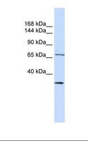 SEMA6D / Semaphorin 6D Antibody - 721_B cell lysate. Antibody concentration: 1.0 ug/ml. Gel concentration: 6-18%.  This image was taken for the unconjugated form of this product. Other forms have not been tested.