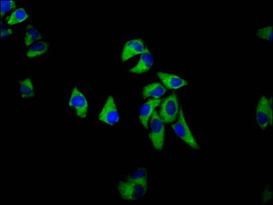 SEMA6D / Semaphorin 6D Antibody - Immunofluorescence staining of Hela cells diluted at 1:133, counter-stained with DAPI. The cells were fixed in 4% formaldehyde, permeabilized using 0.2% Triton X-100 and blocked in 10% normal Goat Serum. The cells were then incubated with the antibody overnight at 4°C.The Secondary antibody was Alexa Fluor 488-congugated AffiniPure Goat Anti-Rabbit IgG (H+L).