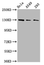 SEMA6D / Semaphorin 6D Antibody - Western Blot Positive WB detected in: Hela whole cell lysate, A549 whole cell lysate, 293 whole cell lysate All Lanes: SEMA6D antibody at 3µg/ml Secondary Goat polyclonal to rabbit IgG at 1/50000 dilution Predicted band size: 120, 114, 112, 116, 118, 55, 68 KDa Observed band size: 130 KDa