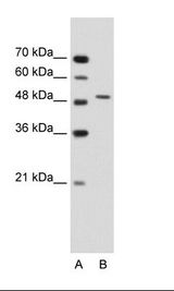 SEMG1 Antibody - A: Marker, B: Jurkat Cell Lysate.  This image was taken for the unconjugated form of this product. Other forms have not been tested.