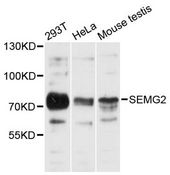 SEMG2 Antibody - Western blot analysis of extracts of various cell lines, using SEMG2 antibody at 1:3000 dilution. The secondary antibody used was an HRP Goat Anti-Rabbit IgG (H+L) at 1:10000 dilution. Lysates were loaded 25ug per lane and 3% nonfat dry milk in TBST was used for blocking. An ECL Kit was used for detection and the exposure time was 30s.