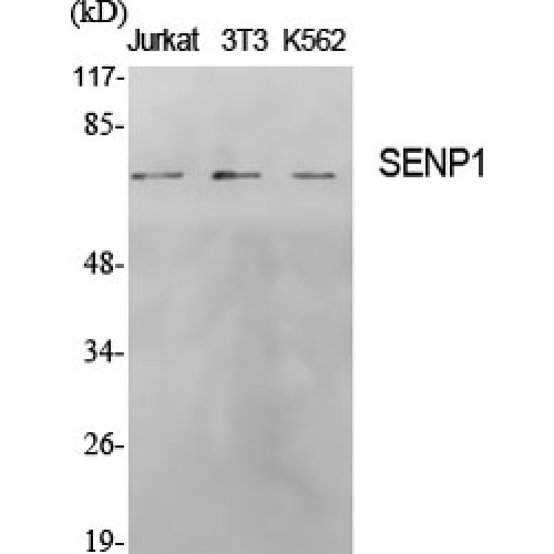 SENP1 Antibody - Western blot of SENP1 antibody