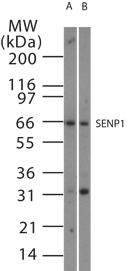 SENP1 Antibody - Western blot of SENP1 in 15 ugs of (A) Jurkat and (B) NIH3T3 cell lysate using antibody at 1:1000.
