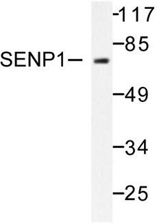 SENP1 Antibody - Western blot of SENP1 (D2) pAb in extracts from Jurkat cells.