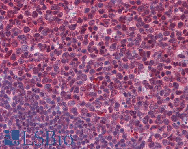 SENP1 Antibody - Anti-SENP1 antibody IHC of human tonsil. Immunohistochemistry of formalin-fixed, paraffin-embedded tissue after heat-induced antigen retrieval. Antibody concentration 5 ug/ml.  This image was taken for the unconjugated form of this product. Other forms have not been tested.