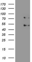 SENP1 Antibody - HEK293T cells were transfected with the pCMV6-ENTRY control (Left lane) or pCMV6-ENTRY SENP1 (Right lane) cDNA for 48 hrs and lysed. Equivalent amounts of cell lysates (5 ug per lane) were separated by SDS-PAGE and immunoblotted with anti-SENP1.