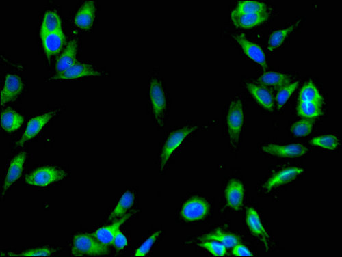 SENP1 Antibody - Immunofluorescent analysis of Hela cells using SENP1 Antibody at a dilution of 1:100 and Alexa Fluor 488-congugated AffiniPure Goat Anti-Rabbit IgG(H+L)
