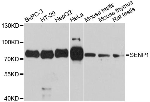 SENP1 Antibody - Western blot analysis of extracts of various cell lines, using SENP1 antibody at 1:3000 dilution. The secondary antibody used was an HRP Goat Anti-Rabbit IgG (H+L) at 1:10000 dilution. Lysates were loaded 25ug per lane and 3% nonfat dry milk in TBST was used for blocking. An ECL Kit was used for detection and the exposure time was 90s.