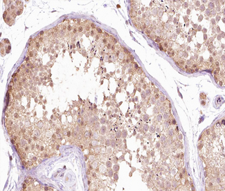 SENP1 Antibody - 1:100 staining human Testis tissue by IHC-P. The tissue was formaldehyde fixed and a heat mediated antigen retrieval step in citrate buffer was performed. The tissue was then blocked and incubated with the antibody for 1.5 hours at 22°C. An HRP conjugated goat anti-rabbit antibody was used as the secondary.