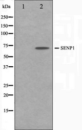 SENP1 Antibody - Western blot analysis on Jurkat cell lysates using SENP1 antibody. The lane on the left is treated with the antigen-specific peptide.