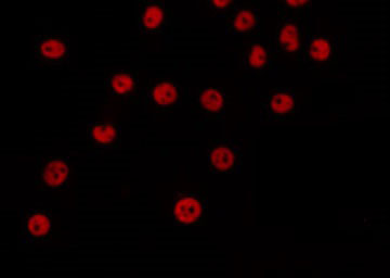 SENP1 Antibody - Staining HeLa cells by IF/ICC. The samples were fixed with PFA and permeabilized in 0.1% Triton X-100, then blocked in 10% serum for 45 min at 25°C. The primary antibody was diluted at 1:200 and incubated with the sample for 1 hour at 37°C. An Alexa Fluor 594 conjugated goat anti-rabbit IgG (H+L) Ab, diluted at 1/600, was used as the secondary antibody.