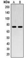 SENP1 Antibody - Western blot analysis of SENP1 expression in Jurkat (A); HL60 (B) whole cell lysates.