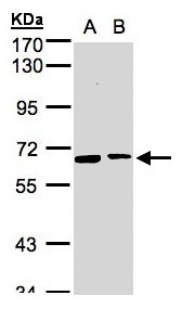 SENP2 Antibody - Sample (30 ug whole cell lysate). A:293T, B: MOLT4 . 7.5% SDS PAGE. SENP2 antibody diluted at 1:1000