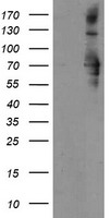 SENP2 Antibody - HEK293T cells were transfected with the pCMV6-ENTRY control (Left lane) or pCMV6-ENTRY SENP2 (Right lane) cDNA for 48 hrs and lysed. Equivalent amounts of cell lysates (5 ug per lane) were separated by SDS-PAGE and immunoblotted with anti-SENP2.