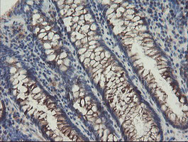 SENP2 Antibody - IHC of paraffin-embedded Human colon tissue using anti-SENP2 mouse monoclonal antibody. (Heat-induced epitope retrieval by 10mM citric buffer, pH6.0, 100C for 10min).