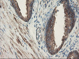 SENP2 Antibody - IHC of paraffin-embedded Human prostate tissue using anti-SENP2 mouse monoclonal antibody. (Heat-induced epitope retrieval by 10mM citric buffer, pH6.0, 100C for 10min).