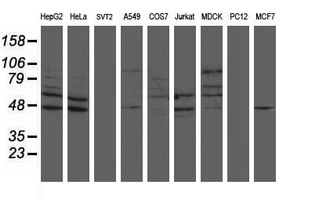 SENP2 Antibody - Western blot of extracts (35 ug) from 9 different cell lines by using g anti-SENP2 monoclonal antibody (HepG2: human; HeLa: human; SVT2: mouse; A549: human; COS7: monkey; Jurkat: human; MDCK: canine; PC12: rat; MCF7: human).
