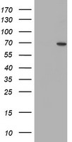 SENP2 Antibody - HEK293T cells were transfected with the pCMV6-ENTRY control (Left lane) or pCMV6-ENTRY SENP2 (Right lane) cDNA for 48 hrs and lysed. Equivalent amounts of cell lysates (5 ug per lane) were separated by SDS-PAGE and immunoblotted with anti-SENP2.