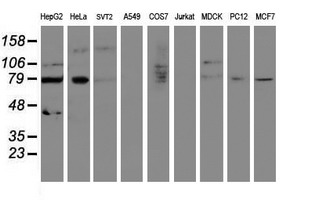 SENP2 Antibody - Western blot of extracts (35ug) from 9 different cell lines by using anti-SENP2 monoclonal antibody (HepG2: human; HeLa: human; SVT2: mouse; A549: human; COS7: monkey; Jurkat: human; MDCK: canine; PC12: rat; MCF7: human).