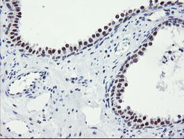 SENP2 Antibody - IHC of paraffin-embedded Human prostate tissue using anti-SENP2 mouse monoclonal antibody.