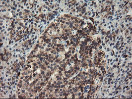 SENP2 Antibody - IHC of paraffin-embedded Human pancreas tissue using anti-SENP2 mouse monoclonal antibody. (Heat-induced epitope retrieval by 10mM citric buffer, pH6.0, 100C for 10min).