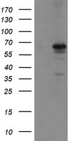 SENP2 Antibody - HEK293T cells were transfected with the pCMV6-ENTRY control (Left lane) or pCMV6-ENTRY SENP2 (Right lane) cDNA for 48 hrs and lysed. Equivalent amounts of cell lysates (5 ug per lane) were separated by SDS-PAGE and immunoblotted with anti-SENP2.