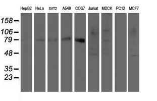 SENP2 Antibody - Western blot of extracts (35ug) from 9 different cell lines by using anti-SENP2 monoclonal antibody (HepG2: human; HeLa: human; SVT2: mouse; A549: human; COS7: monkey; Jurkat: human; MDCK: canine; PC12: rat; MCF7: human).