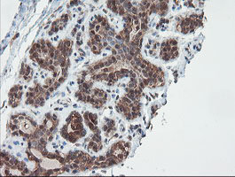 SENP2 Antibody - IHC of paraffin-embedded Human breast tissue using anti-SENP2 mouse monoclonal antibody. (Heat-induced epitope retrieval by 10mM citric buffer, pH6.0, 100C for 10min).