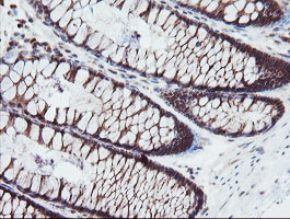 SENP2 Antibody - IHC of paraffin-embedded Human colon tissue using anti-SENP2 mouse monoclonal antibody. (Heat-induced epitope retrieval by 10mM citric buffer, pH6.0, 100C for 10min).