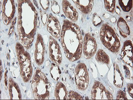 SENP2 Antibody - IHC of paraffin-embedded Human Kidney tissue using anti-SENP2 mouse monoclonal antibody. (Heat-induced epitope retrieval by 10mM citric buffer, pH6.0, 100C for 10min).