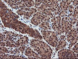 SENP2 Antibody - IHC of paraffin-embedded Human pancreas tissue using anti-SENP2 mouse monoclonal antibody. (Heat-induced epitope retrieval by 10mM citric buffer, pH6.0, 100C for 10min).