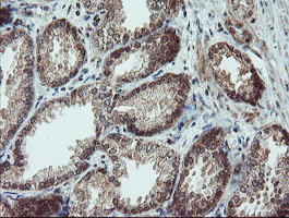 SENP2 Antibody - IHC of paraffin-embedded Human prostate tissue using anti-SENP2 mouse monoclonal antibody. (Heat-induced epitope retrieval by 10mM citric buffer, pH6.0, 100C for 10min).