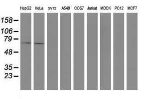 SENP2 Antibody - Western blot of extracts (35ug) from 9 different cell lines by using anti-SENP2 monoclonal antibody (HepG2: human; HeLa: human; SVT2: mouse; A549: human; COS7: monkey; Jurkat: human; MDCK: canine; PC12: rat; MCF7: human).