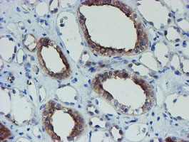 SENP2 Antibody - IHC of paraffin-embedded Human Kidney tissue using anti-SENP2 mouse monoclonal antibody.