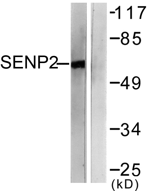 SENP2 Antibody - Western blot analysis of lysates from MDA-MB-435 cells, using SENP2 Antibody. The lane on the right is blocked with the synthesized peptide.