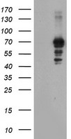 SENP2 Antibody - HEK293T cells were transfected with the pCMV6-ENTRY control (Left lane) or pCMV6-ENTRY SENP2 (Right lane) cDNA for 48 hrs and lysed. Equivalent amounts of cell lysates (5 ug per lane) were separated by SDS-PAGE and immunoblotted with anti-SENP2.