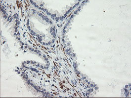 SENP2 Antibody - IHC of paraffin-embedded Human prostate tissue using anti-SENP2 mouse monoclonal antibody.