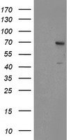 SENP2 Antibody - HEK293T cells were transfected with the pCMV6-ENTRY control (Left lane) or pCMV6-ENTRY SENP2 (Right lane) cDNA for 48 hrs and lysed. Equivalent amounts of cell lysates (5 ug per lane) were separated by SDS-PAGE and immunoblotted with anti-SENP2.