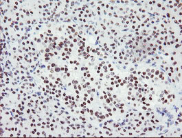 SENP2 Antibody - IHC of paraffin-embedded Human pancreas tissue using anti-SENP2 mouse monoclonal antibody.