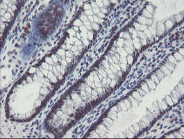 SENP2 Antibody - IHC of paraffin-embedded Human colon tissue using anti-SENP2 mouse monoclonal antibody.