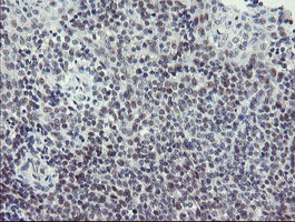 SENP2 Antibody - IHC of paraffin-embedded Human tonsil using anti-SENP2 mouse monoclonal antibody.