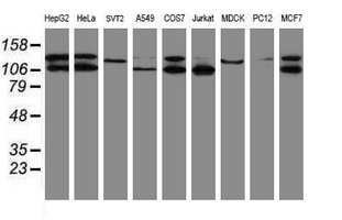SENP2 Antibody - Western blot of extracts (35 ug) from 9 different cell lines by using g anti-SENP2 monoclonal antibody (HepG2: human; HeLa: human; SVT2: mouse; A549: human; COS7: monkey; Jurkat: human; MDCK: canine; PC12: rat; MCF7: human).