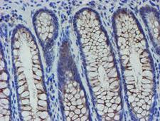 SENP2 Antibody - IHC of paraffin-embedded Human colon tissue using anti-SENP2 mouse monoclonal antibody.