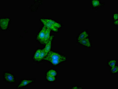 SENP2 Antibody - Immunofluorescent analysis of HepG2 cells at a dilution of 1:100 and Alexa Fluor 488-congugated AffiniPure Goat Anti-Rabbit IgG(H+L)